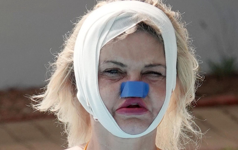 ФОТО ГАЛЕРИЈА: Пластичните операции ѝ го УНАКАЗИЈА лицето на Даниела, сега се обидува да го спаси